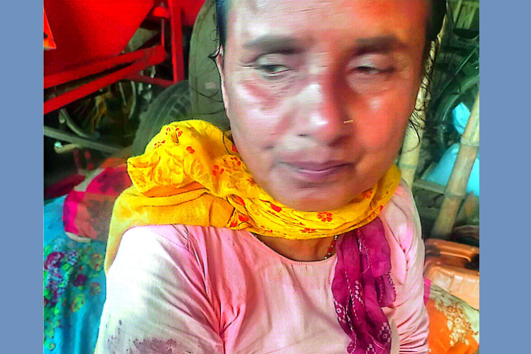 बोक्सीको आरोप लगाउँदै महिलामाथि निर्घात कुटपिट